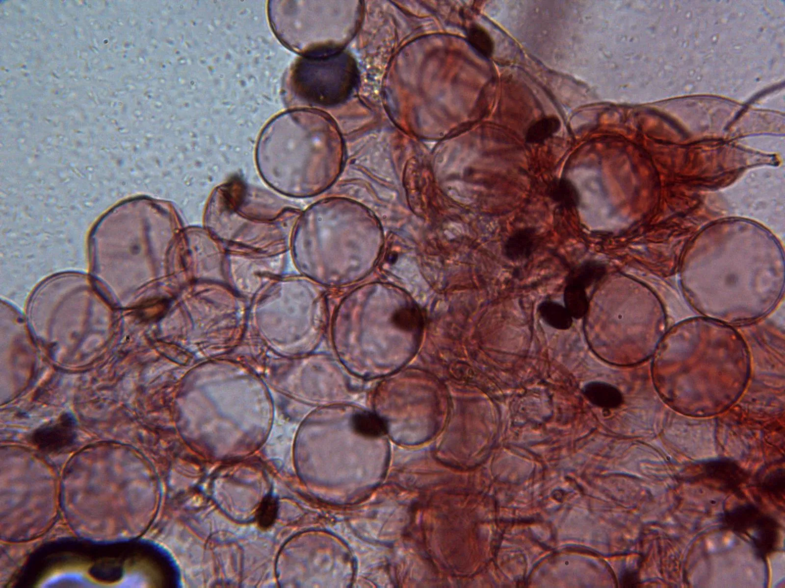 Microscopía de Parasola conopilea - 10 - Pileipellis x 400 2